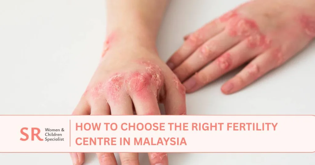 10 early signs of hfmd children a guide for parents