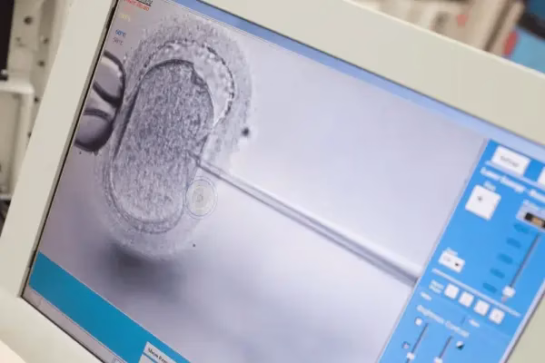 fertility medication pregnancy ultrasound